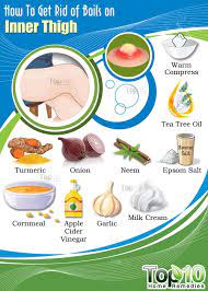 How To Prevent Treat Boils On Inner Thighs Emedihealth Get Rid Of Boils Home Remedy For Boils Boil Remedies