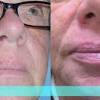 What does skin cancer look like? Https Encrypted Tbn0 Gstatic Com Images Q Tbn And9gcqhk9iauiuicak0rkn5f3ka 0k2nqdl9u Sefa9zq Tnm Gvbxl Usqp Cau