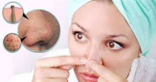 عشان تحافظى على جمال بشرتك زيت السمسم للتخلص من الرؤوس السوداء اليوم السابع