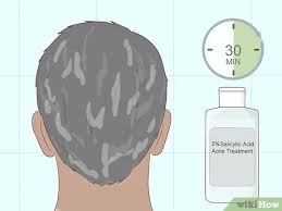 Can i pass a hair follicle test in 70 days. How To Pass A Hair Follicle Drug Test With Pictures Wikihow