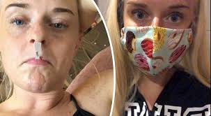 Pap test annullato per il lockdown: «Ora ho il cancro al collo dell'utero»