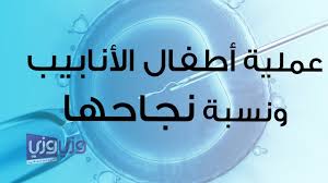 عملية أطفال الأنابيب بالتفصيل ونسبة نجاحها Youtube