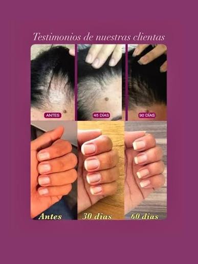 No hay ningún colágeno igual y nuestras clientas no nos dejan mentir 🥹❤️ # colageno #renovaplus #uñassanasyfuertes #biopectidosactivos #ᴄᴜɪᴅᴀᴅᴏᴘᴇʀsᴏɴᴀʟ