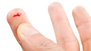 Why Paper Cuts Hurt So Much - Bbc Future