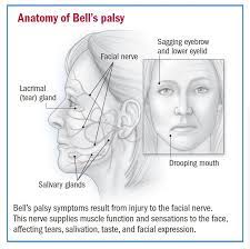 Bell's palsy itself is not life threatening and is rarely serious. Bell S Palsy Overview Harvard Health