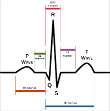 Understanding The Ekg Signal Atrial Fibrillation Resources For Patients