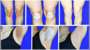 Kararmis Koltuk Alti Kararmis Dizler Nasil Beyazlatilir 100 Challenge Yontem Guzellik Bakim Youtube