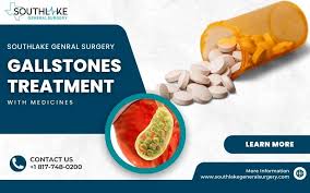Image result for Gallstone