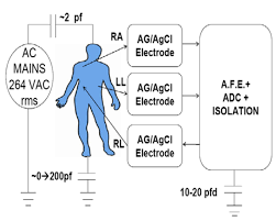 Find and reach ecg consultancy ltd's employees by department, seniority. Mitigation Strategies For Ecg Design Challenges Analog Devices