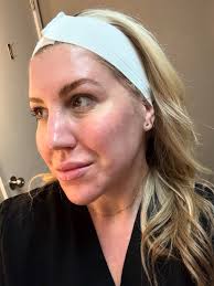 Ashley BSN, RN, PHN Nurse Injector at Rella Aesthetic's Medspa