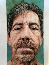 Art by Gregory J Moorman, MD