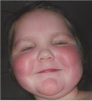 Keith Ehrman-Deming Obituary (2009