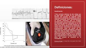 También da una sola descarga eléctrica. Aspectos Teoricos Para El Uso Del Desfibrilador Monofasico Y Bifasico Youtube