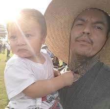 Sick Coyote Spotted in Costa Mesa, California