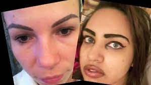 This may include eyebrows, powder eyebrows, lash enhancement, eyeliner, beauty marks, lip liners, and full lip color, just to name a few. Permanent Makeup Can Lead To Cosmetic Tattoo Nightmares Cbs Miami
