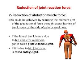 Regional Biomechanics Hip Joint Ppt Video Online Download