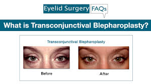 Image result for Blepharis transvaalensis