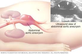 Treatment there are numerous therapies for pelvic pain, and the precise treatment needed depends on the underlying cause. Abdominal Ultrasound Mayo Clinic