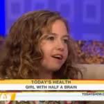 L'histoire de Cameron, qui vit sans hémisphère droit, bouleverse l'Amérique  !