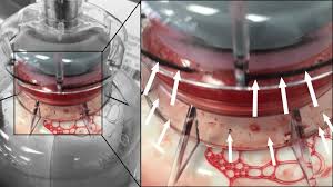 Sur l'ensemble du plasma prélevé par le service du sang, 10 % seront transfusés tels quel après un traitement approprié. Des Donneurs De Plasma Et De Plaquettes Sont Ils Mis En Danger Par Des Particules Cancerigenes Basta