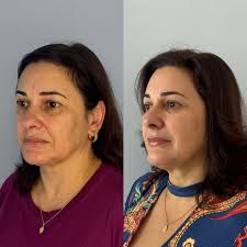 Elisa Alonso (@draelisaalonso) • Instagram photos and videos