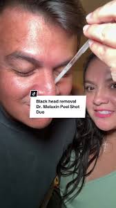 Dr. Melaxin Peel Shot Duo: Effective Blackhead Removal