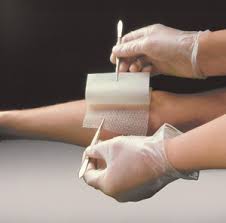 Image result for Antimicrobial Dressing