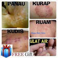 Inilah rahasia obat ku4t paling ampuh di dunia dari dokter boyke part 2, inilah rahasia obat kuat paling ampuh di dunia dari dokter boyke, lelaki muda panik masalah mati pucuk, nikita mirzani jual obat perkasa pria cumiflash, bagaimana penggunaan obat kuat untuk membantu aktivitas seksual ini. Ubat Gatal Herba Mujarab Ubat Kurap Ubat Ekzema Eczema Sensitive Kulit Shopee Malaysia