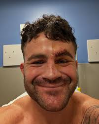 Little grappling Boo Boo from me wrestling like a spaz #whoops #mma #bjj  #jiujitsu #wrestling #bjjlifestyle