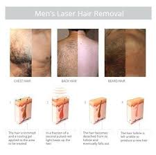 Normal hair removal methods like shaving, epilating, and waxing were all doable at home but were not lasting solutions. Ipl Hair Removal Bikini Review Hairremovalpermanent Hair Removal Cream Bikini Hair Removal Ipl Hair Removal