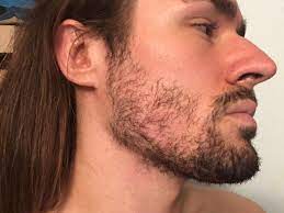 I can grow facial hair fairly quickly, (though it isn't exactly that thick but its fairly even), while my brother who is 20 (only 2 years younger!) doesn't really even. Too Patchy To Grow Or Should I Keep Going Beards