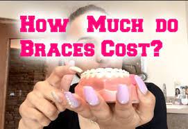 Here are some average prices: How Much Do Braces For Adults Cost Brier Creek Orthodontics