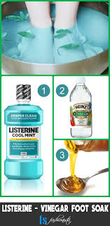 Does the pinterest listerine foot soak really work to dissolve calluses on your feet? 7 Listerine Foot Soak Recipes For Baby Soft Feet Listerine Feet Listerine Foot Soak Foot Soak Recipe