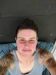 MS is so much fun in warm temperatures. "Omg your face is so red..." Yup.  Sure is.