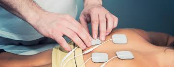 Image result for Electrical Stimulation Therapy