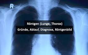 · last updated:january 9, 2021. Rontgen Thorax Lunge Grunde Ablauf Bilder Praktischarzt