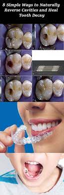 Pin On Soins Bucco Dentaires