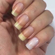 We've all experienced an unpleasant acrylic nail pain at least once. Broken Nail Repair What To Do When It S Bad Nail Care Hq