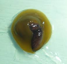 Image result for Polysphaeria harrisii