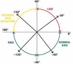 The Basics Of Ecg Interpretation Part 2 Rate Rhythm And