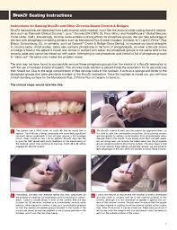 Check spelling or type a new query. Cementation Of Zirconia Crowns