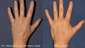 Image result