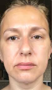 Face Yoga Method Results