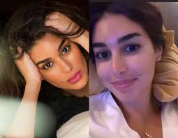 (لا يجوزُ إجراءُ جِراحةِ التَّجميلِ التَّحسينيَّةِ التي لا تدخُلُ في العِلاجِ الطِّبيِّ، ويُقصَدُ منها تغييرُ خِلقةِ الإنسانِ السَّوِيَّة تبعًا للهوى والرَّغَباتِ بالتقليدِ للآخَرينَ، مثل عمليَّات تغييرِ شَكلِ الوَجهِ للظُّهورِ بمَظهرٍ مُعَيَّنٍ. Ù…Ø§ Ø§Ù„Ø³Ø± ÙˆØ±Ø§Ø¡ Ø§Ù„Ù„ÙˆÙƒ Ø§Ù„Ø·Ø¨ÙŠØ¹ÙŠ Ù„ÙŠØ§Ø³Ù…ÙŠÙ† ØµØ¨Ø±ÙŠ Ø¨Ø¯ÙˆÙ† Ù…ÙƒÙŠØ§Ø¬ Ø§Ø­ÙƒÙŠ