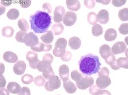 Image result for Peripheral Smear