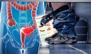 It's available to everyone aged 60 or over. Bowel Cancer Symptoms What A Healthy Stool Looks Like Express Co Uk