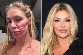 Brandi Glanville Uses Nair on Her Face as a 'Beauty Hack' amid Facial  'Parasite' Crisis