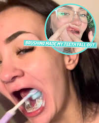 I look like a grandma after I had to spent $10k