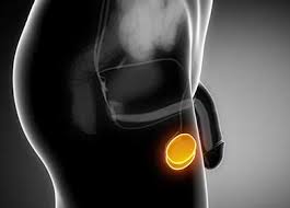 Check spelling or type a new query. Cancer Du Testicule Symptomes Diagnostic Traitements