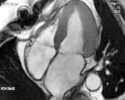 Das herz ist ganz klar das symbol der liebe und des lebens. Kardio Mrt Diagnostik Rund Ums Herz Herzkatheter Vermeiden